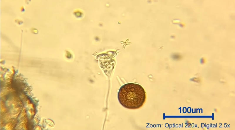 วอร์ติเซลลา (Vorticella sp.)