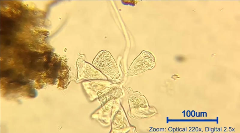 วอร์ติเซลล่า​ ​(Vorticella sp.)