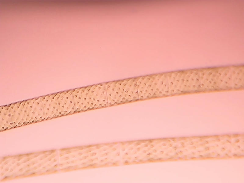 Spirogyra sp.