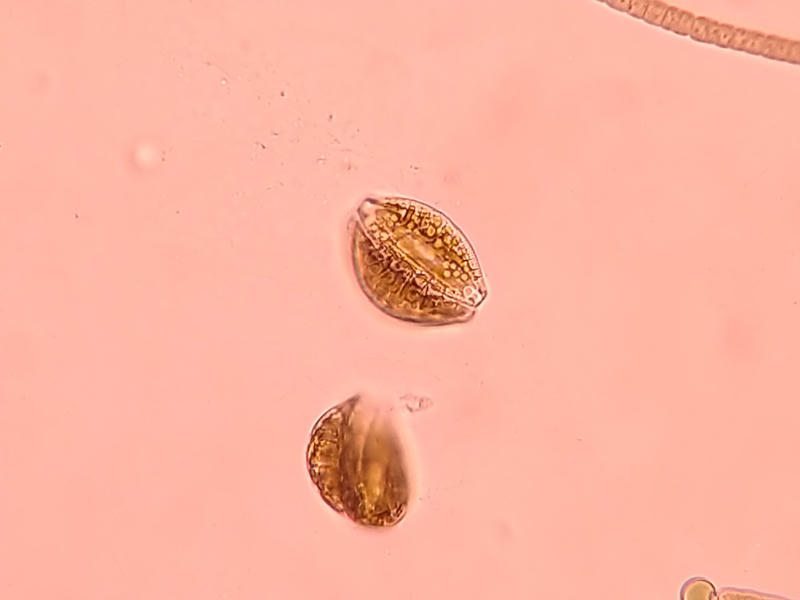 Epithemia sp.