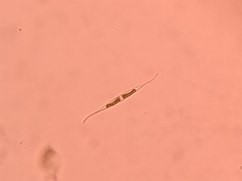 Nitzchia sp.