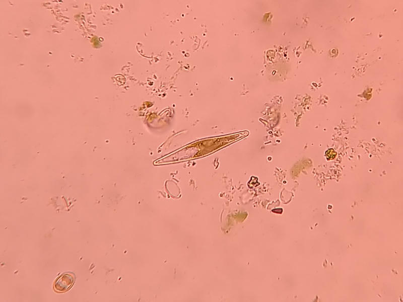 Gomphonema sp.