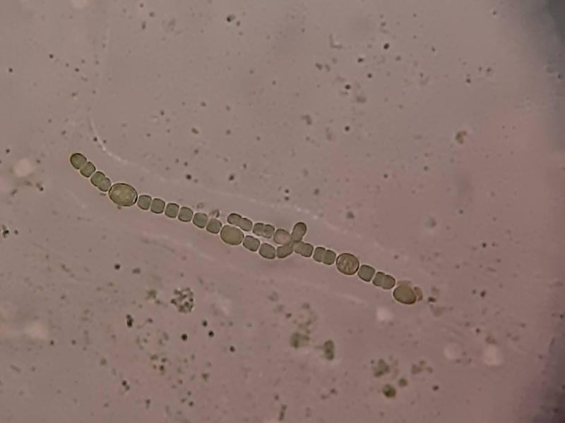 Anabaena sp.