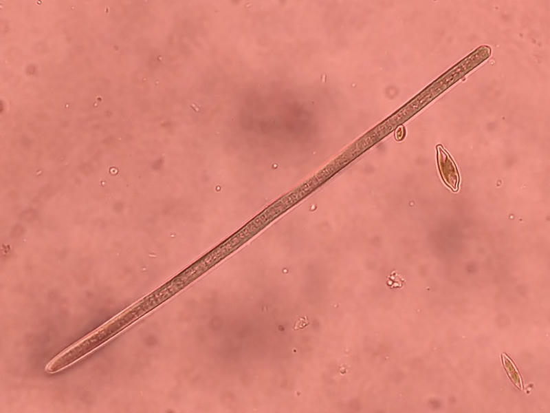 Phormidium sp.