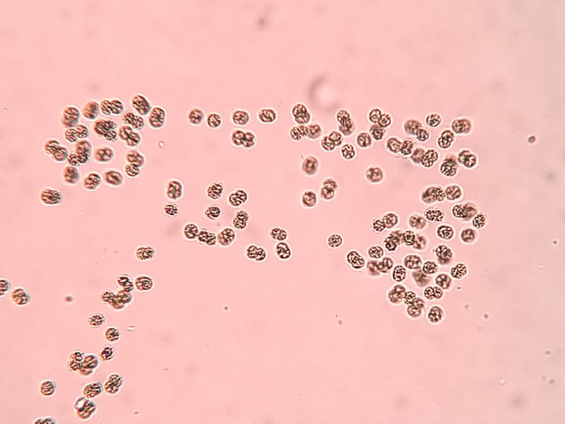 Microcystis sp