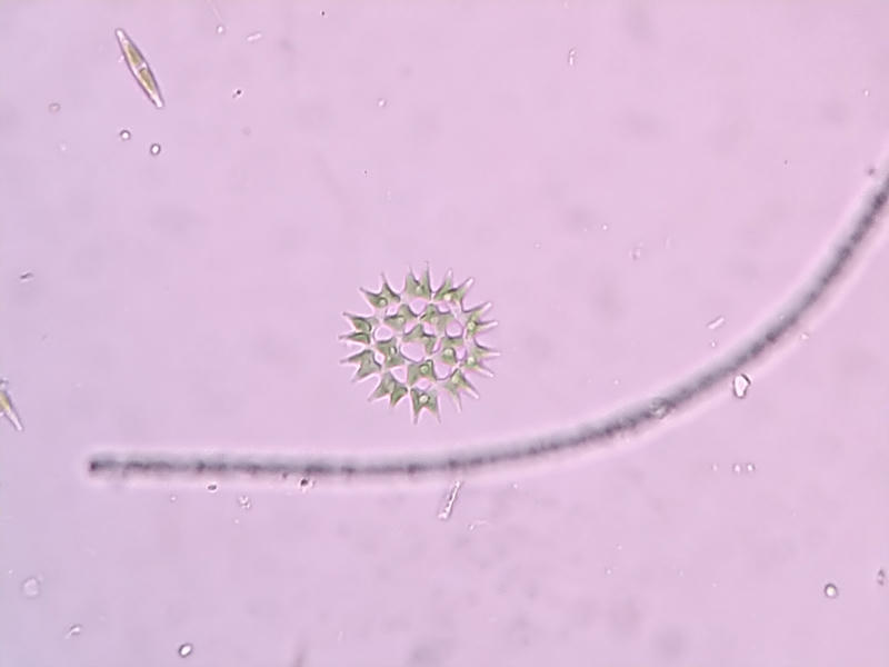 Pediastrum sp.