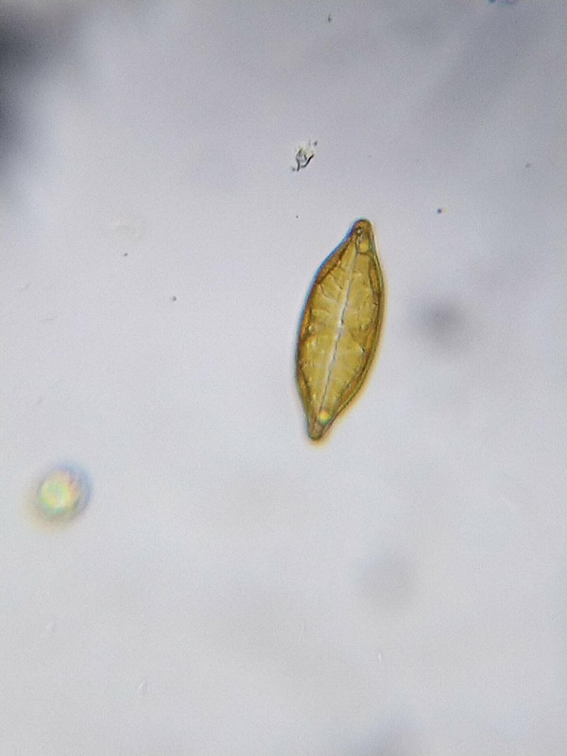 Geissleria sp.