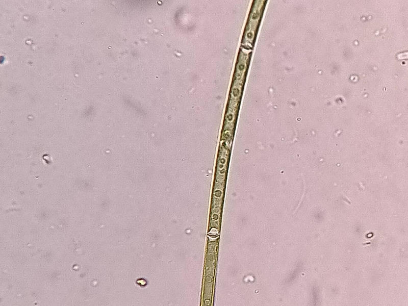 Mougeotia sp.