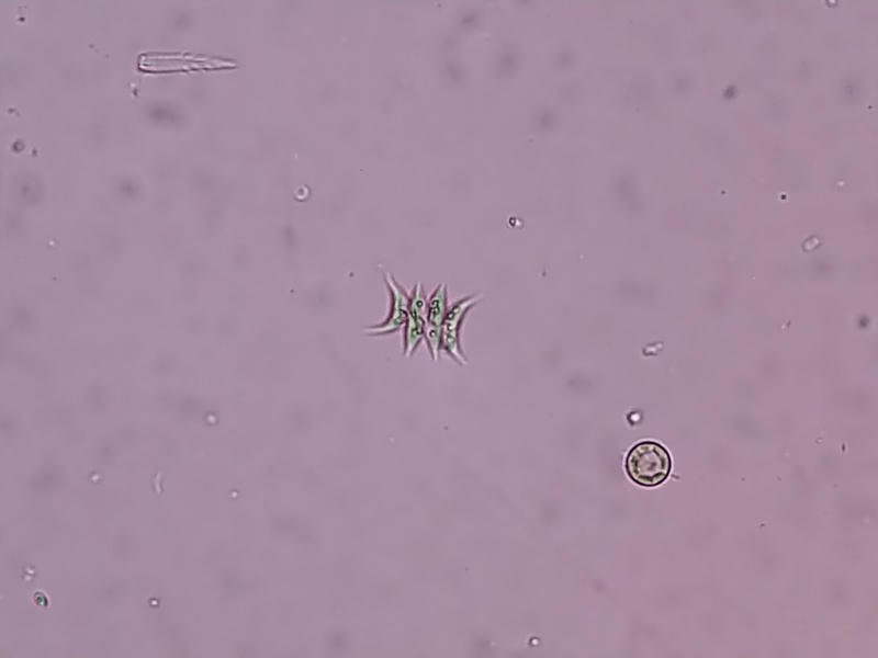 Scenedesmus sp.