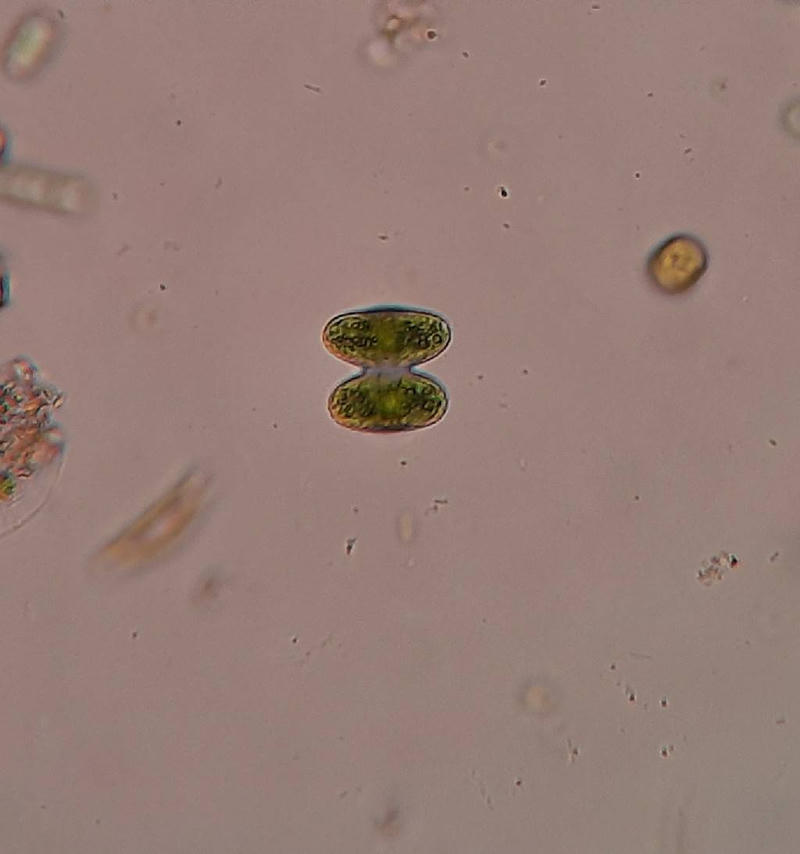 Staurodesmus sp.
