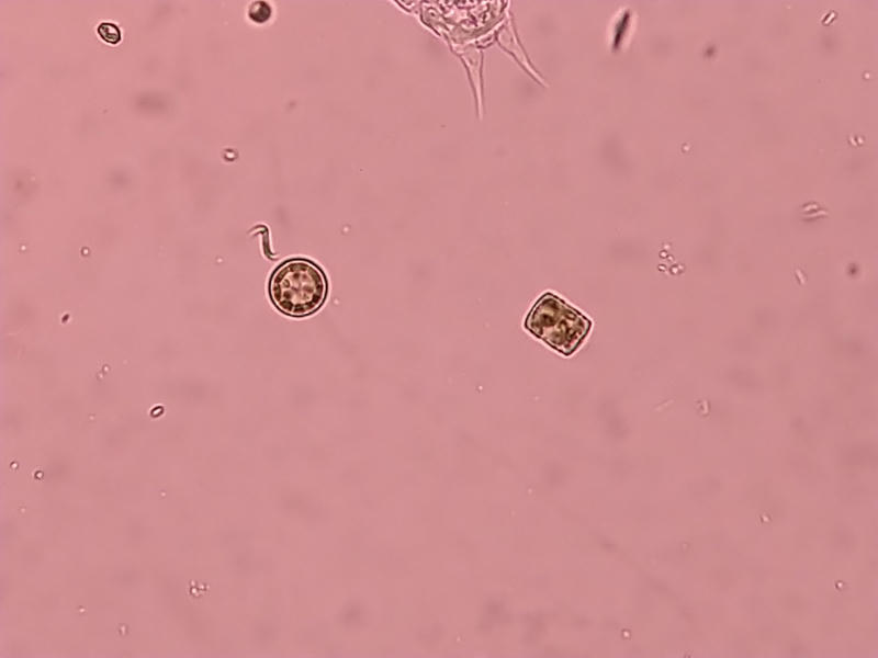 Cyclotella sp.