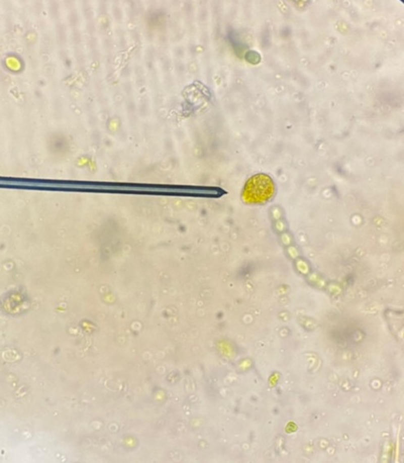Peridiniopsis sp.