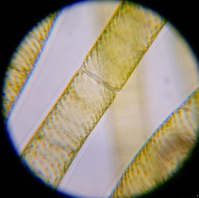 Spirogyra sp.