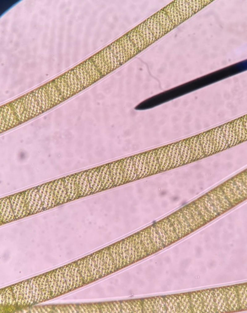 Spirogyra sp.