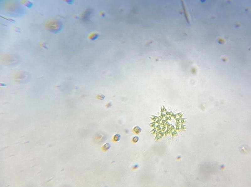 Pediastrum sp.