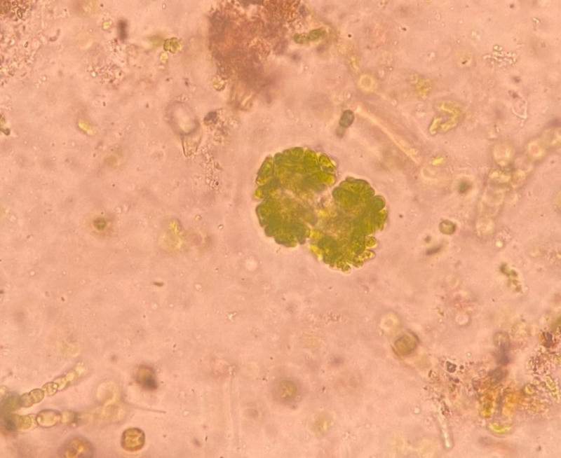 Botrycoccus sp.