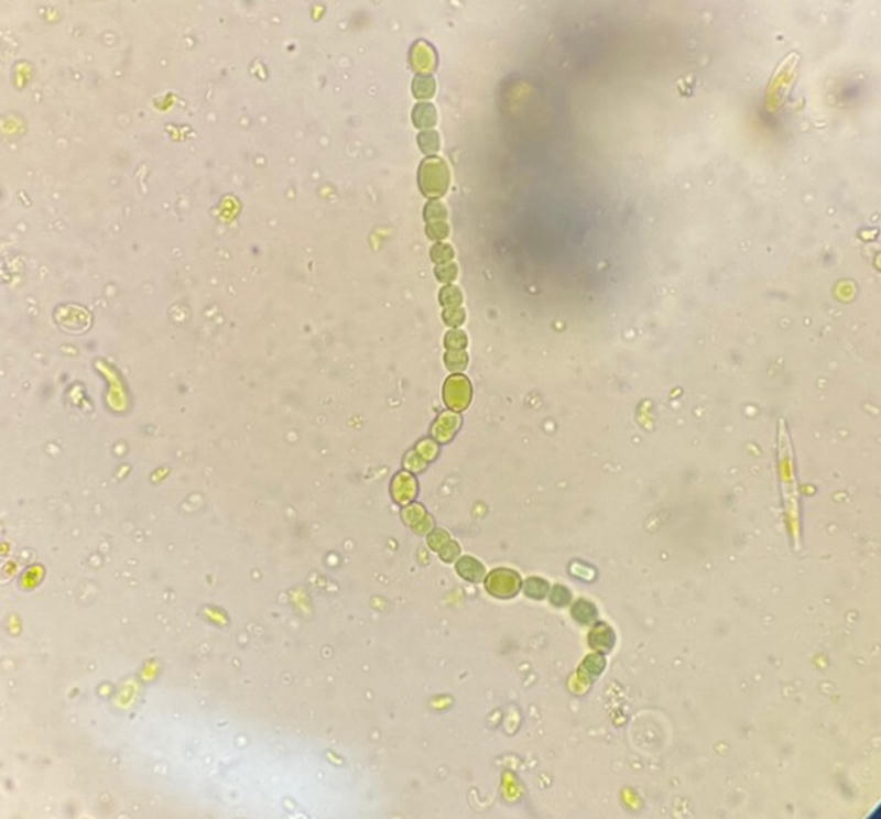 Anabaena sp.