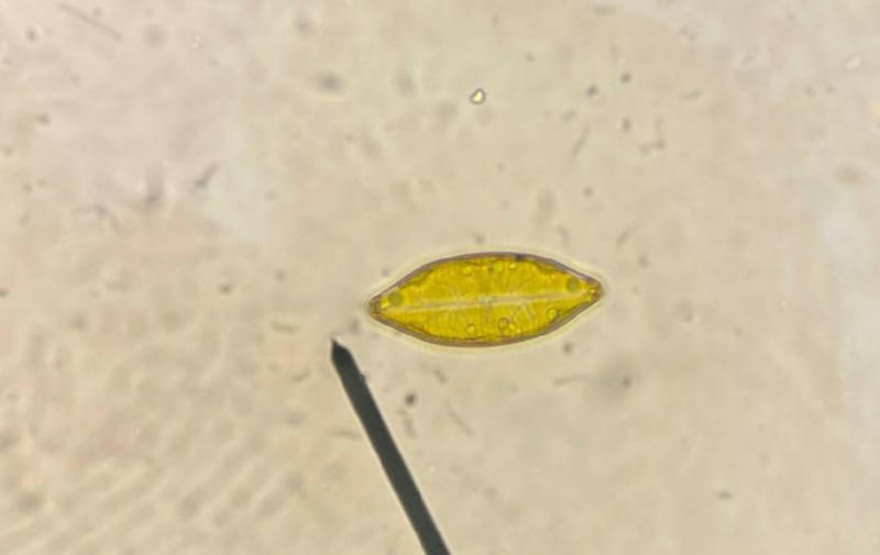 Geissleria sp.