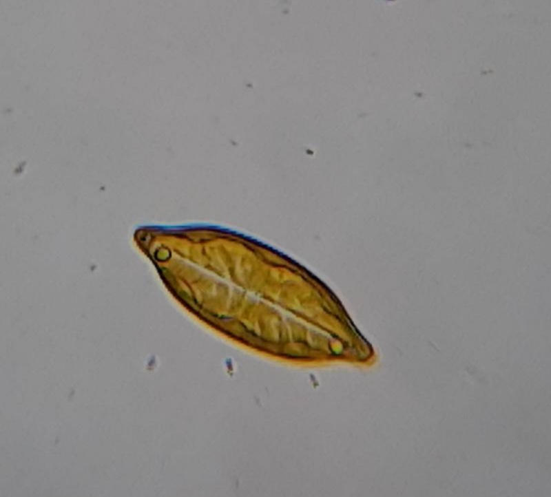 Geissleria sp.