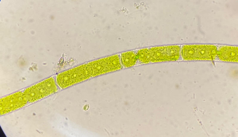Mougeotia sp.