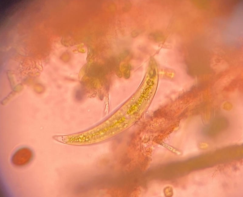 Closterium sp.