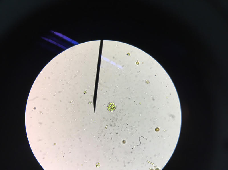 Pediastrum sp.