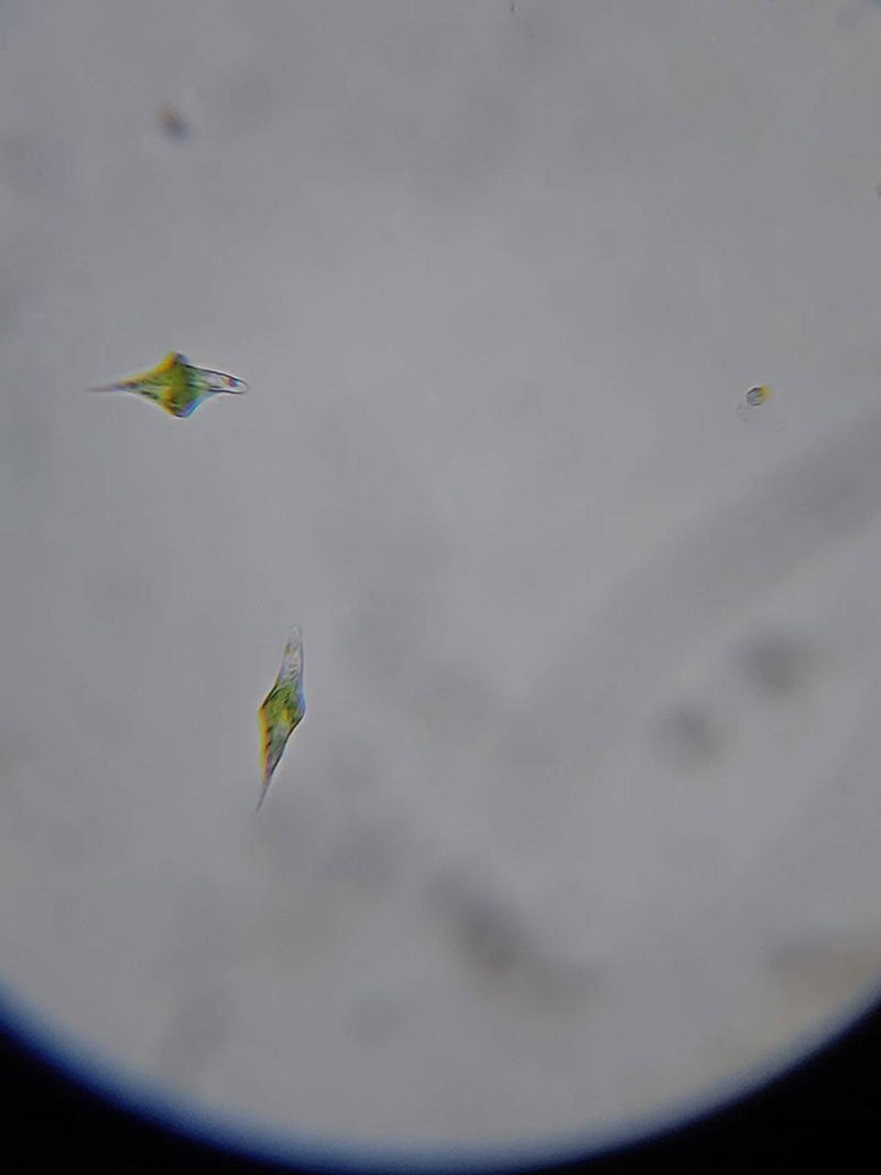 Euglena sp.