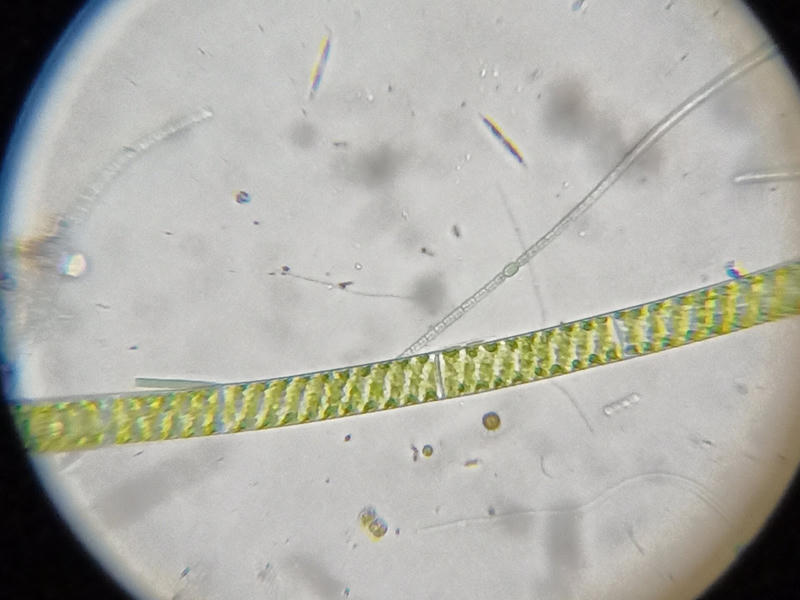 Spirogyra sp.