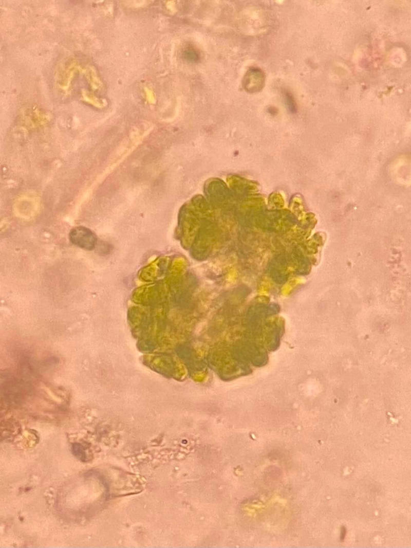Dimorphococcus sp.