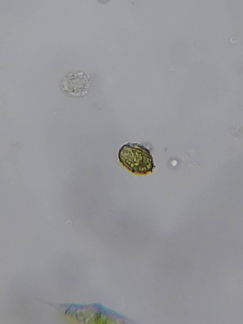 Trachelomonas sp.