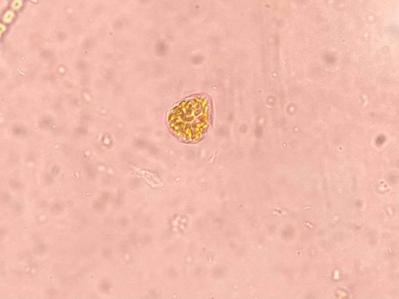 Peridiniopsis sp.