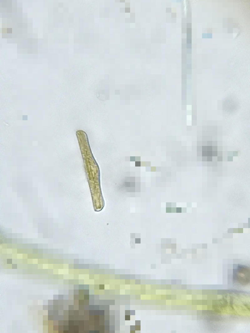 Rhopalodia sp.