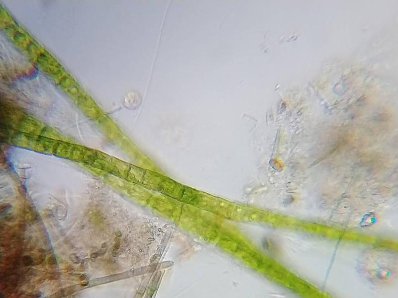 Oedogonium sp.
