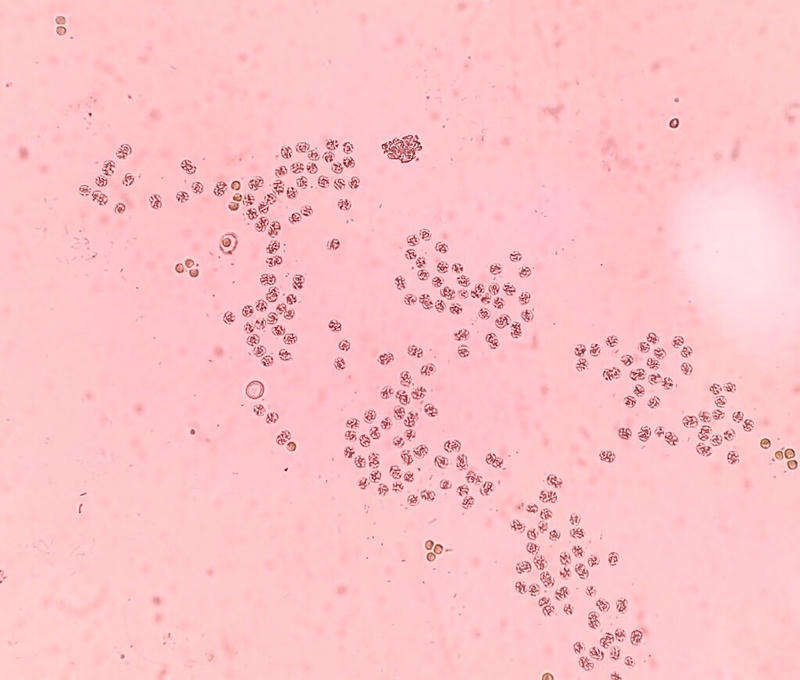 Microcystis sp.