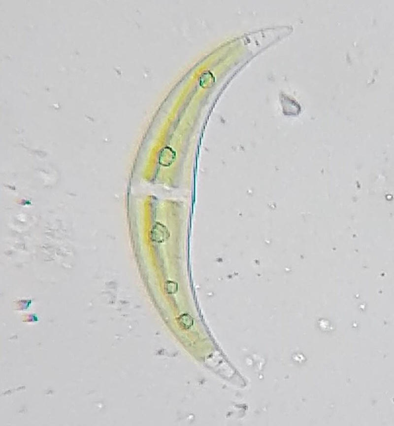 Closterium sp.