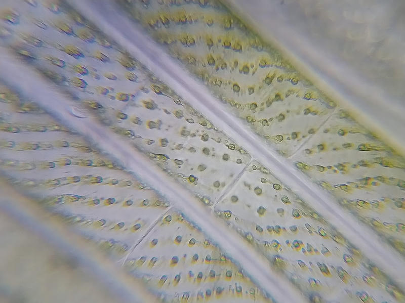Spirogyra sp.