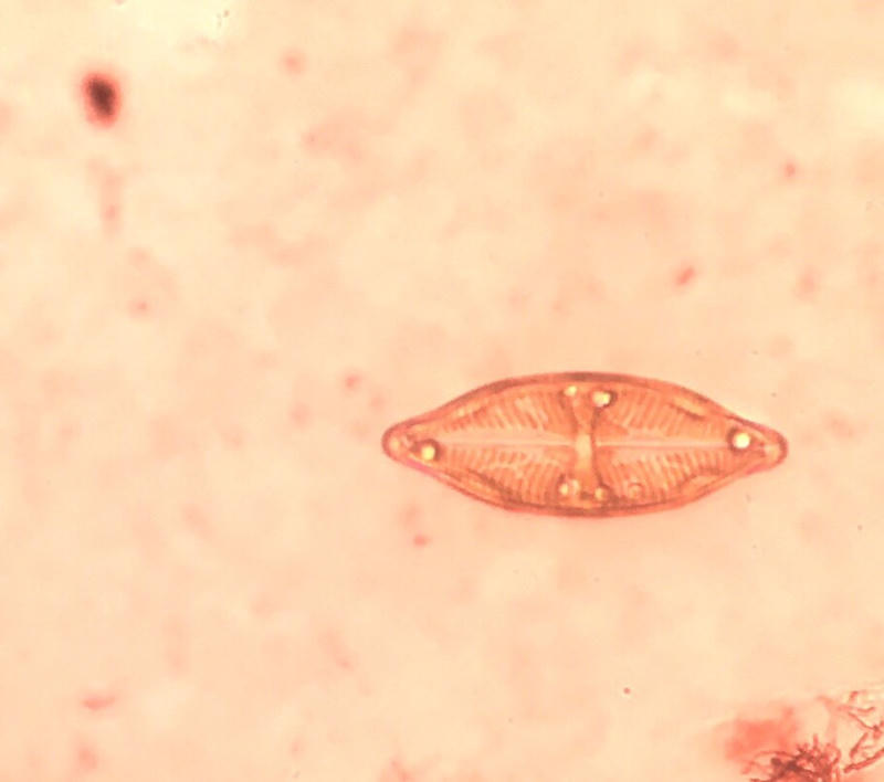 Geissleria sp.