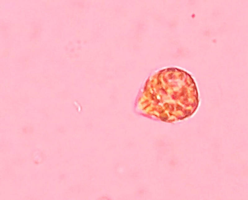 Peridiniopsis sp.
