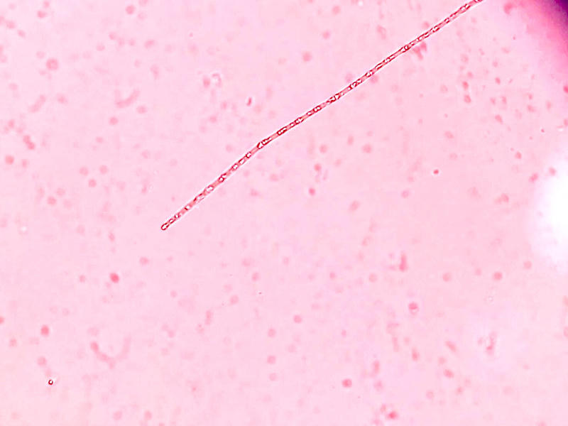 Pseudanabaena sp.