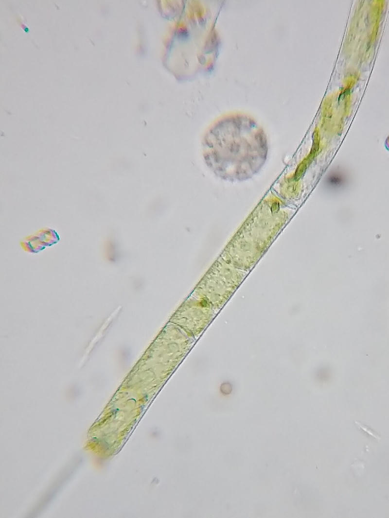 Mougeotia sp.