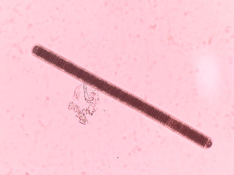 Oscillatoria sp.