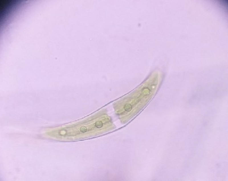Closterium sp.