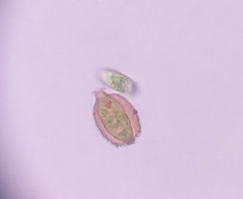 Strombomonas sp.
