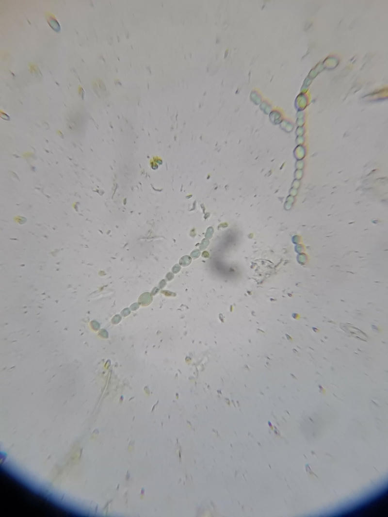 Anabena sp.