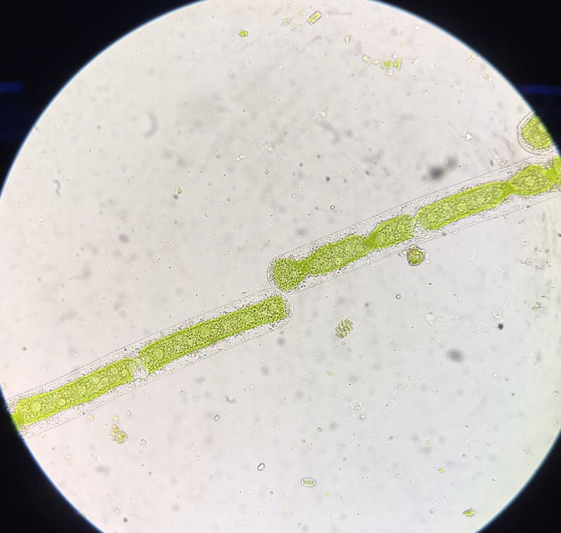 Mougeotia sp.