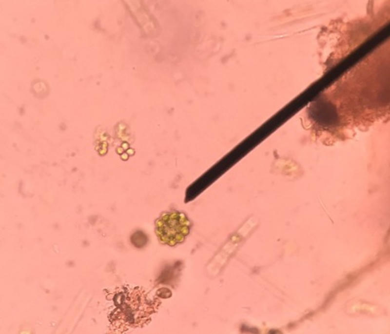 Coelastrum sp.