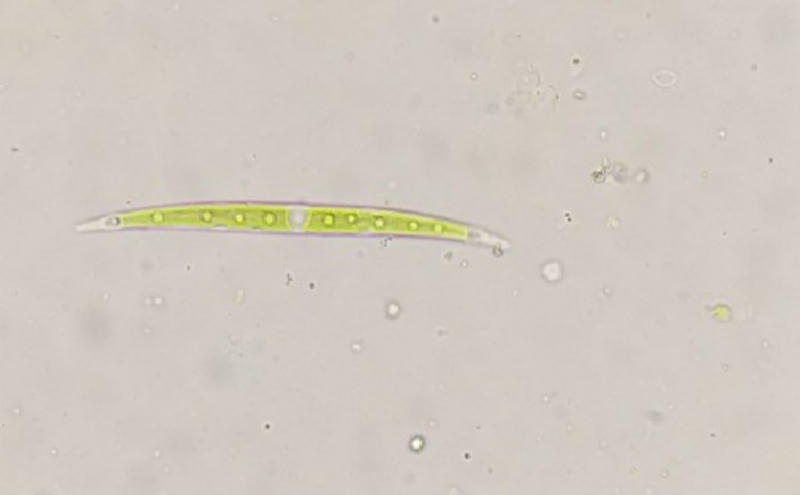 Closterium sp.
