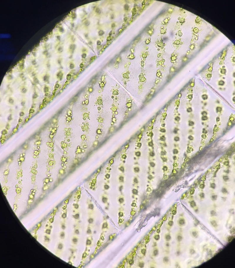 Spirogyra sp.