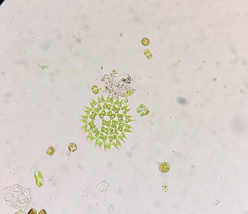Pediastrum sp.