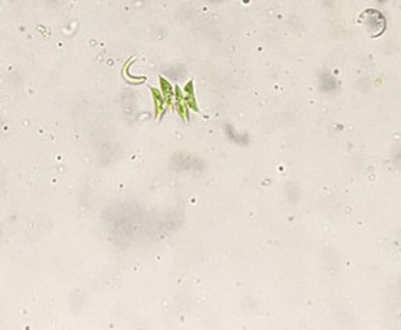 Scenedesmus sp.